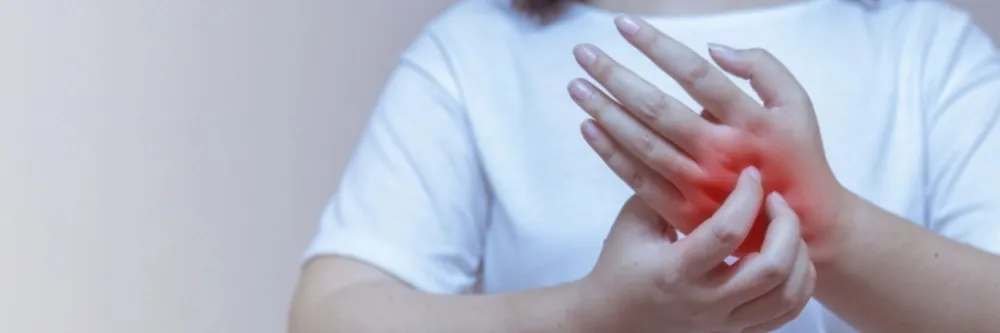  Rheumatoid Arthritis