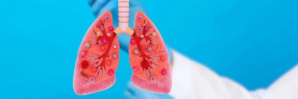 Tuberculosis (TB)