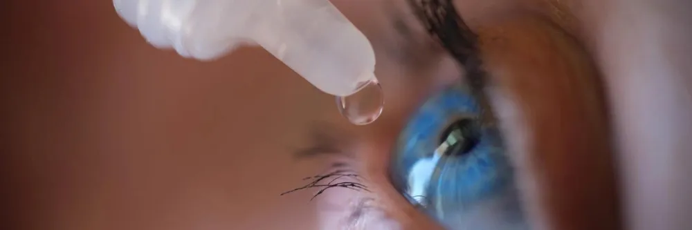  Dry Eye Syndrome