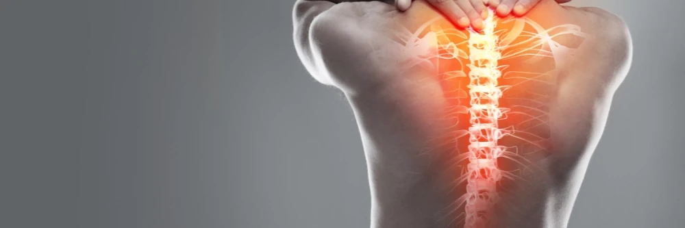 Sciatica
