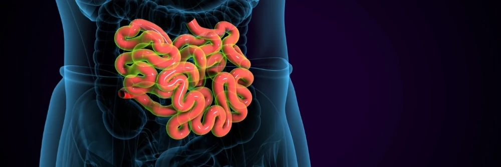 Colorectal Cancer