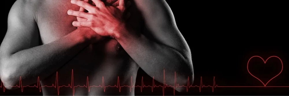 Atrial Fibrillation