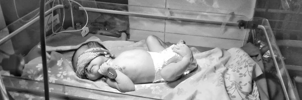  Neonatal Abstinence Syndrome (NAS)