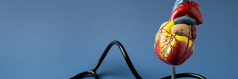 Managing Coronary Artery Disease (CAD)