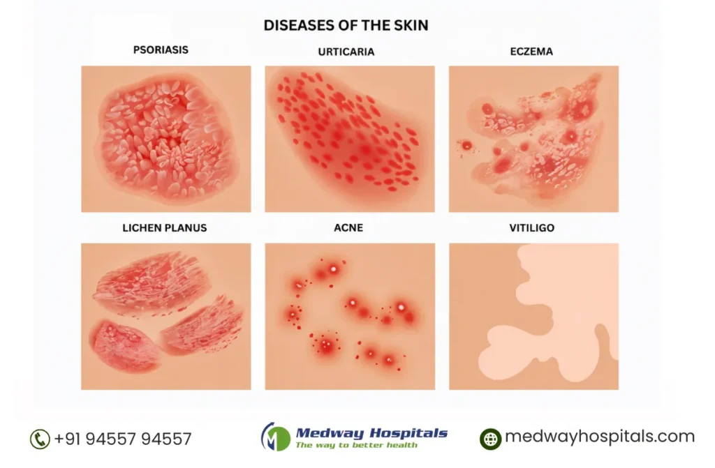 Best Skin Care Hospital in Chennai