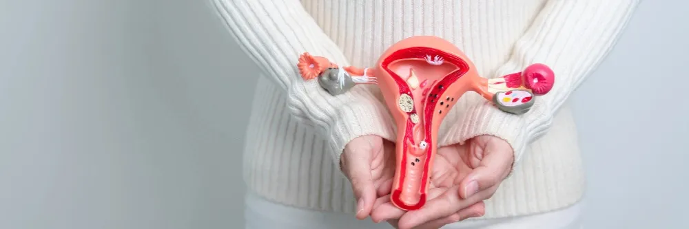Uterine fibroids