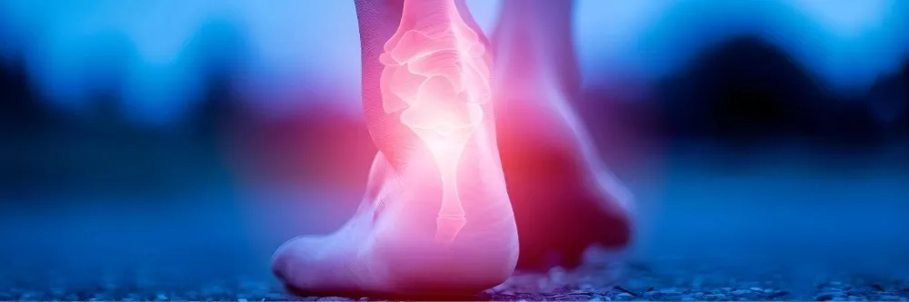 Complex Regional Pain Syndrome (CRPS)