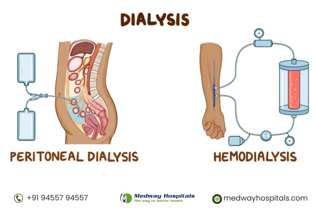 2 Types of Dialysis