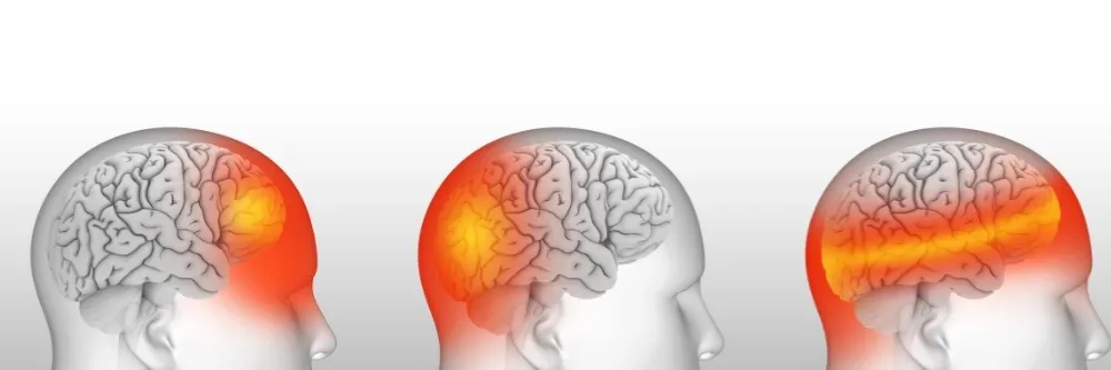 Traumatic Brain Injury