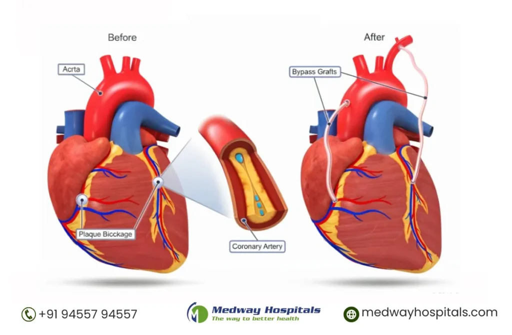 Comprehensive Guide to Cardiothoracic Surgeons in Chennai