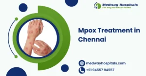 Mpox Treatment in Chennai