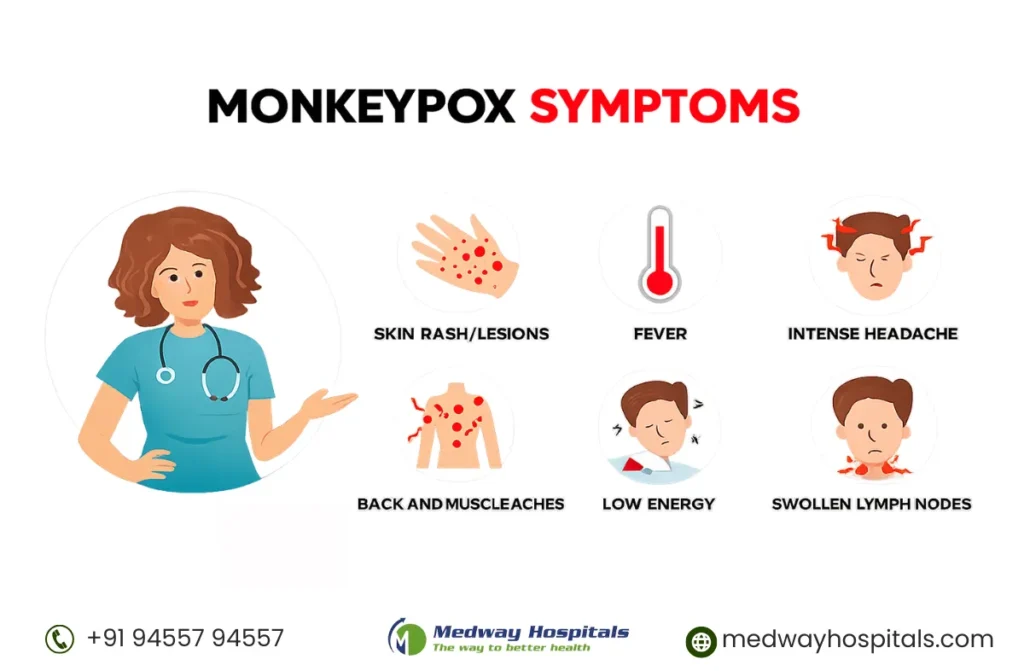 Mpox Treatment in Chennai