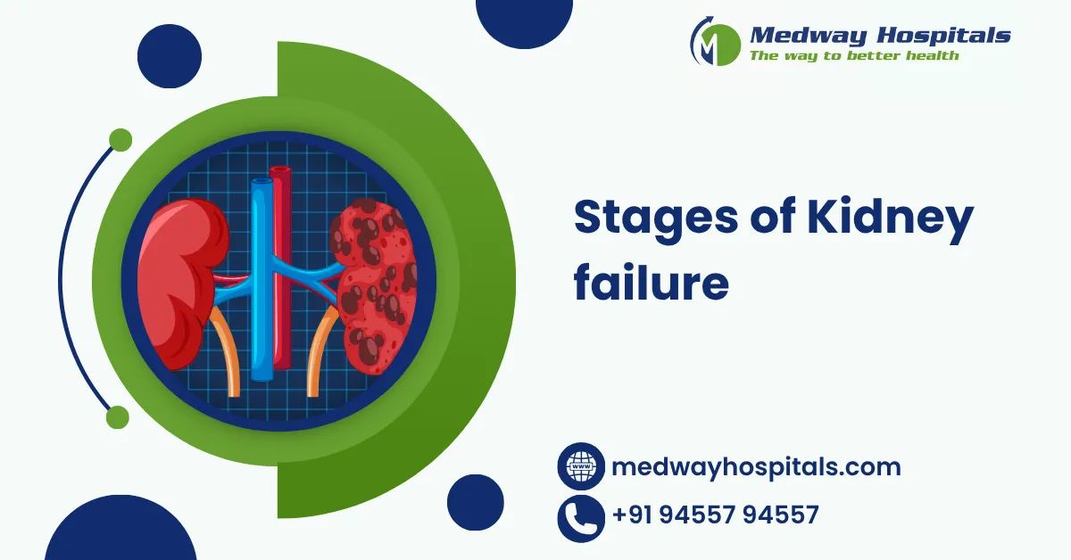 Stages of Kidney failure
