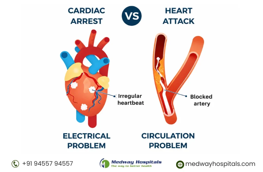 Sudden Cardiac Arrest