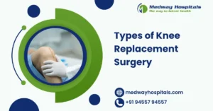 Types of Knee Replacement Surgery