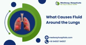 What Causes Fluid Around the Lungs