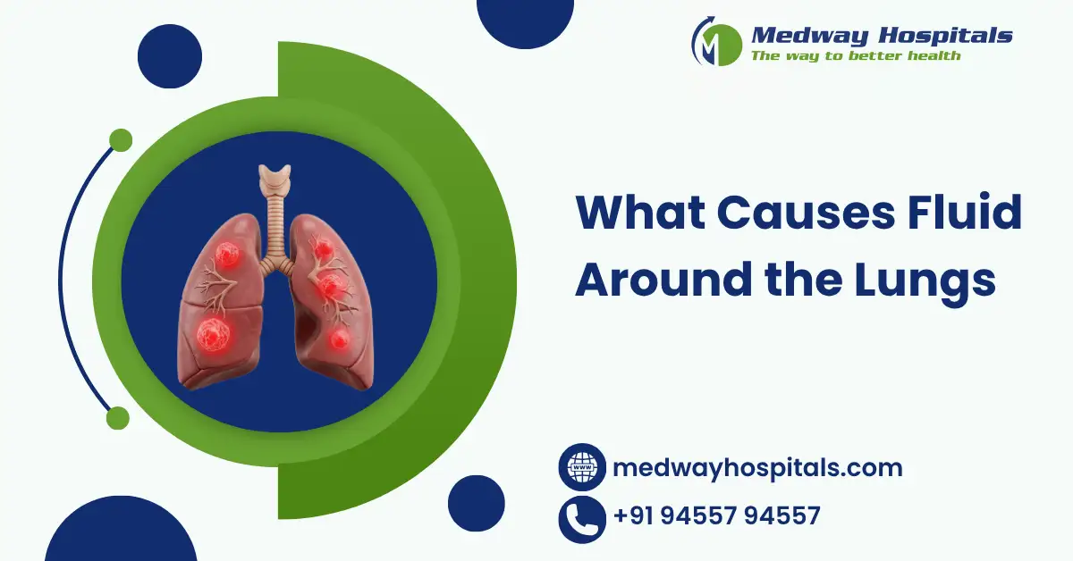 What Causes Fluid Around the Lungs