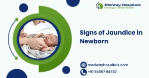 Signs of Jaundice in Newborn