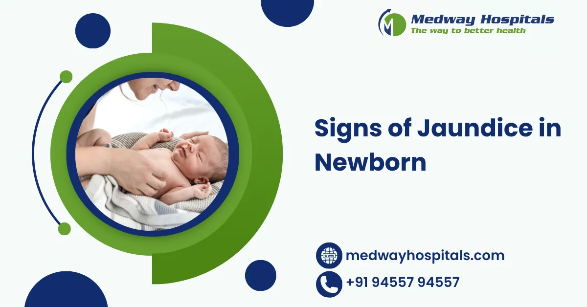 Signs of Jaundice in Newborn